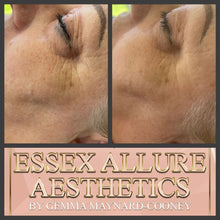 Load image into Gallery viewer, Dermaplaning