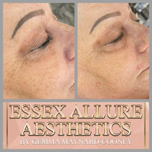 Load image into Gallery viewer, Dermaplaning