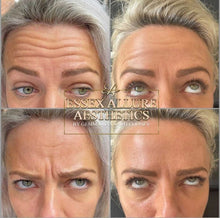 Load image into Gallery viewer, Anti Wrinkle Injections