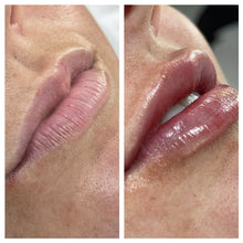 Load image into Gallery viewer, Lip Filler