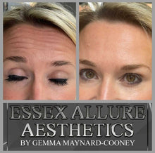 Load image into Gallery viewer, Anti Wrinkle Injections
